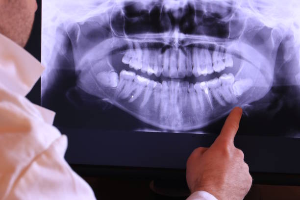 Best After-Hours Emergency Dentist in St George, UT